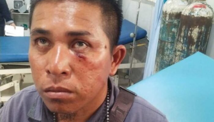 Mafia BBM Oplosan Ilegal di kandis Kembali Beraksi: Wartawan Dikeroyok, polda Riau tindak Tegas para pelaku secara Hukum.