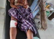 Warga  Diserang Harimau Saat Mencari Damar di Hutan Batang Gansal