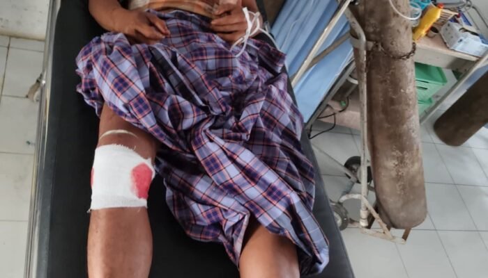 Warga  Diserang Harimau Saat Mencari Damar di Hutan Batang Gansal